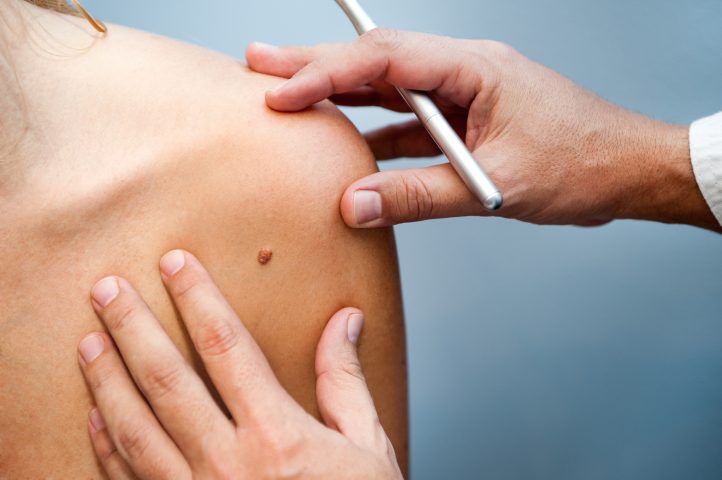 Dezembro Laranja: mais de 180 mil novos casos de câncer de pele são descobertos por ano, no Brasil