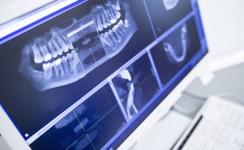 Gustavo Menegucci dentista dos famosos faz tratamentos digitais