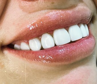 Dra. Thamires Rizzo, transformando sorrisos Dra. Thamires Rizzo, transformando sorrisos