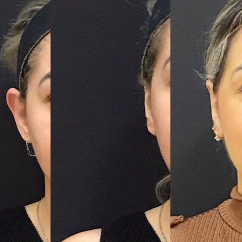 Dra. Vanessa Vieira – Quando o amor tocar, deixe harmonizar Dra. Vanessa Vieira – Quando o amor tocar, deixe harmonizar