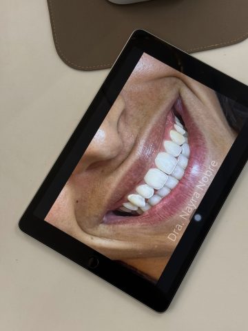 Inovação na odontologia: Dra. Nayra Nobre e o segredo dos sorrisos radiantes