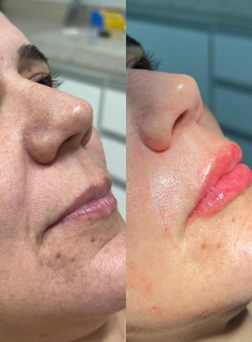Dra. Ana Marques: Da superação à referência na harmonização orofacial Dra. Ana Marques: Da superação à referência na harmonização orofacial