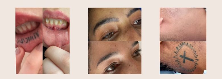 Dra. Eva Borges devolve autoestima com laser e acolhimento Dra. Eva Borges devolve autoestima com laser e acolhimento
