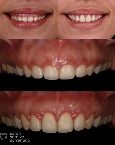Dra. Sarah Saraiva: Um olhar humanizado para transformar sorrisos Dra. Sarah Saraiva: Um olhar humanizado para transformar sorrisos