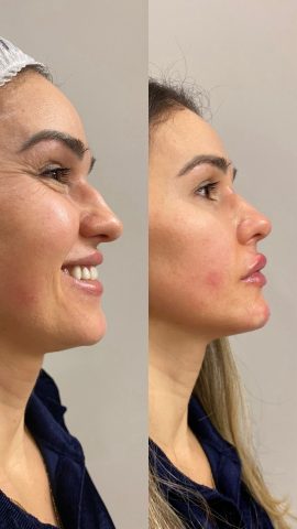 Ciência e arte em sintonia: Dra. Claudiana Melo inicia tratamento estético facial da cantora Izy Monteiro Ciência e arte em sintonia: Dra. Claudiana Melo inicia tratamento estético facial da cantora Izy Monteiro