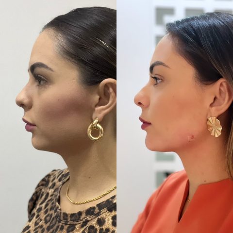 Dra. Bruna Vilela: Estética que respeita a identidade